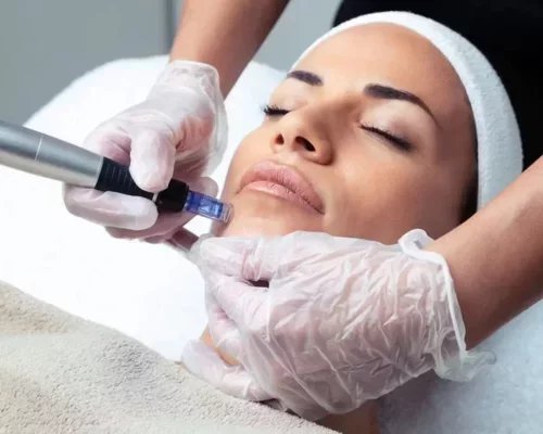 Clemed - Domont - Microneedling